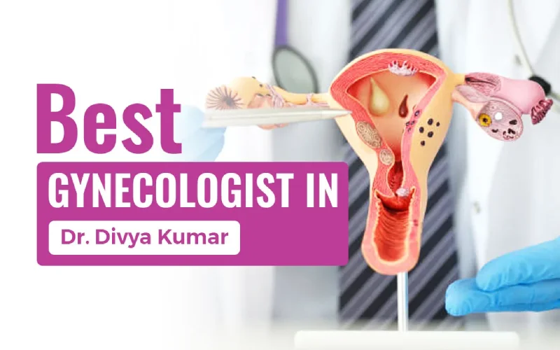 Best Gynecologist in Faridabad – Dr. Divya Kumar